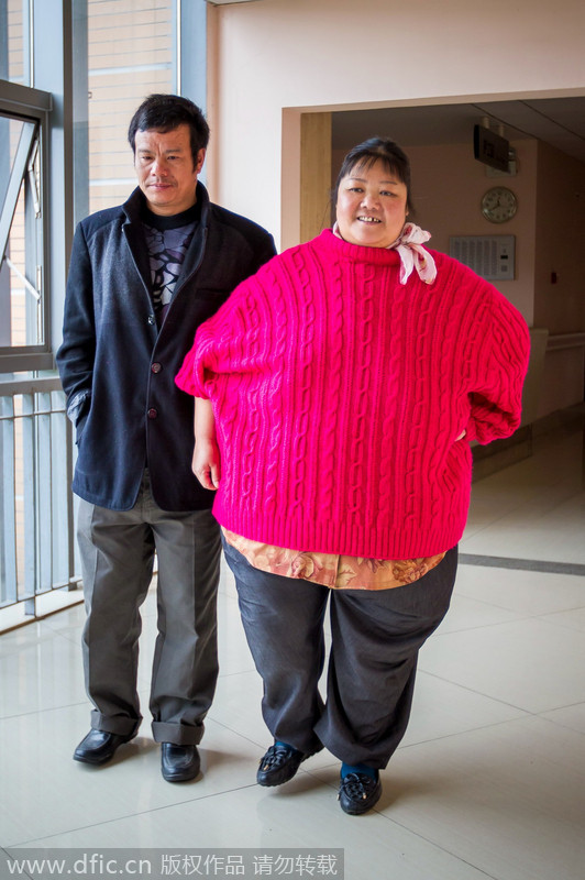 四川超300斤胖姐为抗癌减肥一月瘦20斤