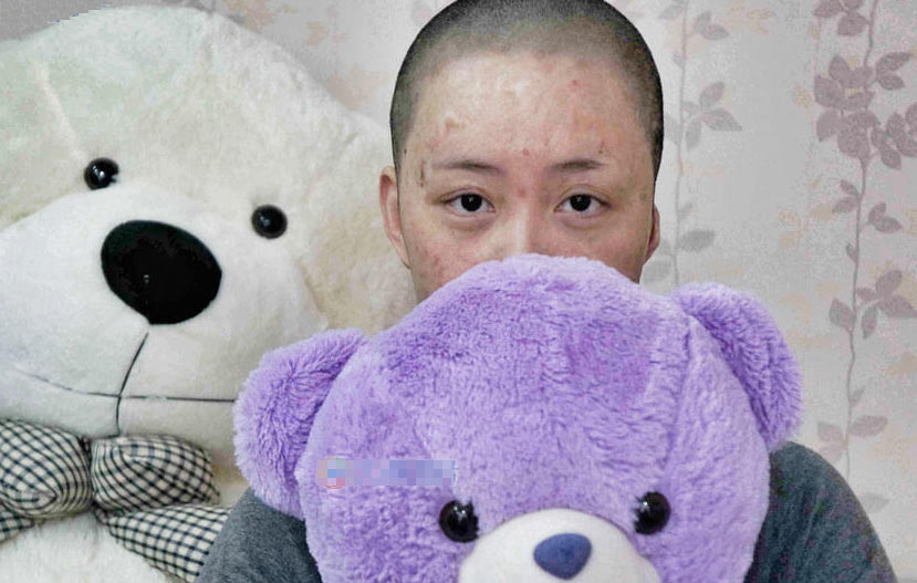被官二代毁容少女索赔360余万元 在北京坐地铁被看哭