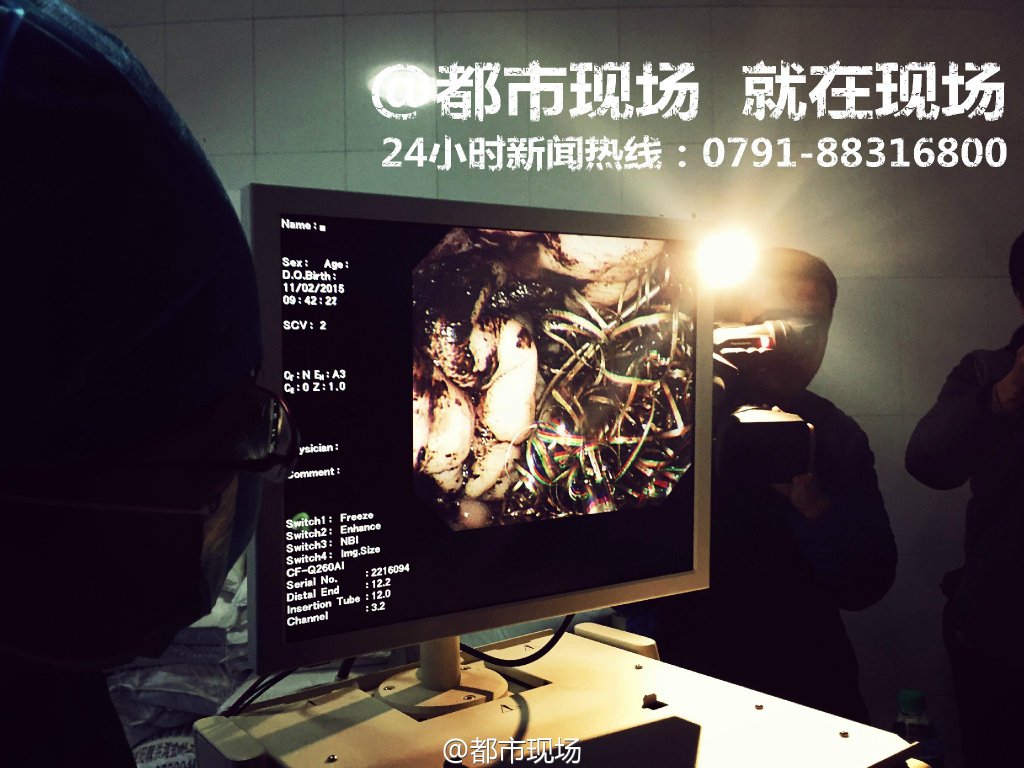 南昌动物园 海豚喉部发现钢丝球