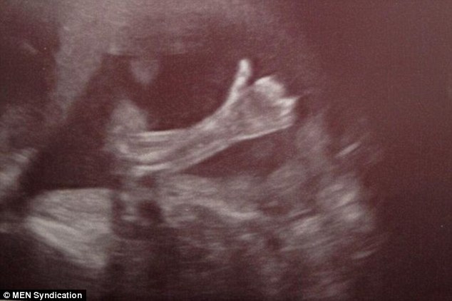 英国20周胎儿向爸妈竖大拇指“问好”