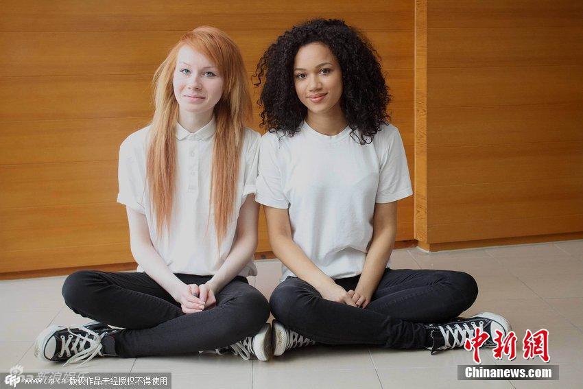 组图：英国黑白双胞胎姐妹走红 概率百万分之一