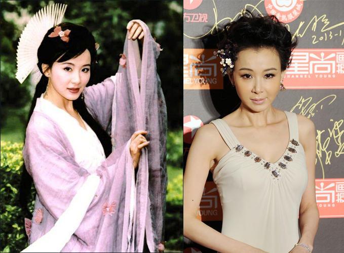 整容后惨不忍睹 “僵脸女神”哪家强