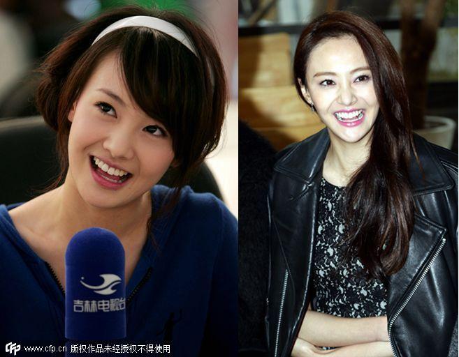 整容后惨不忍睹 “僵脸女神”哪家强