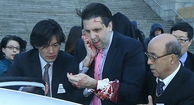 美驻韩大使脸部遭不明武装分子袭击受伤严重