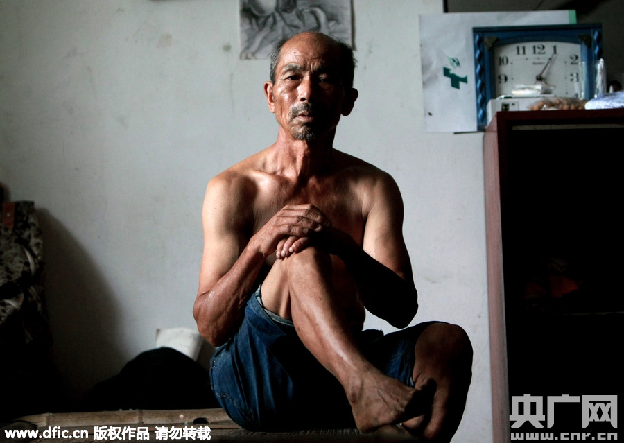 摄影师再度踏访湖南癌症村 仅剩73人常住