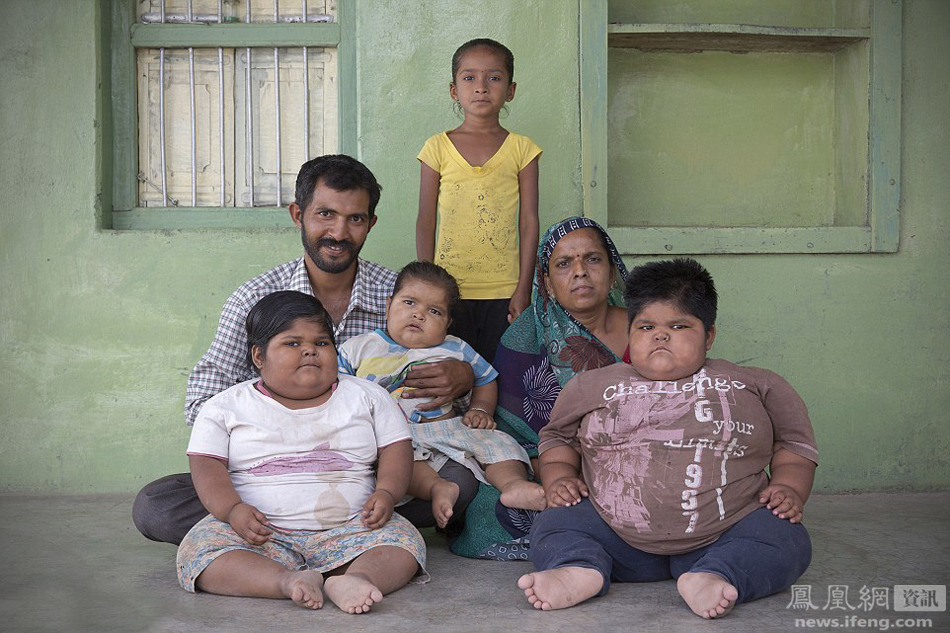 印度：为救三个肥胖孩子父亲决定卖肾