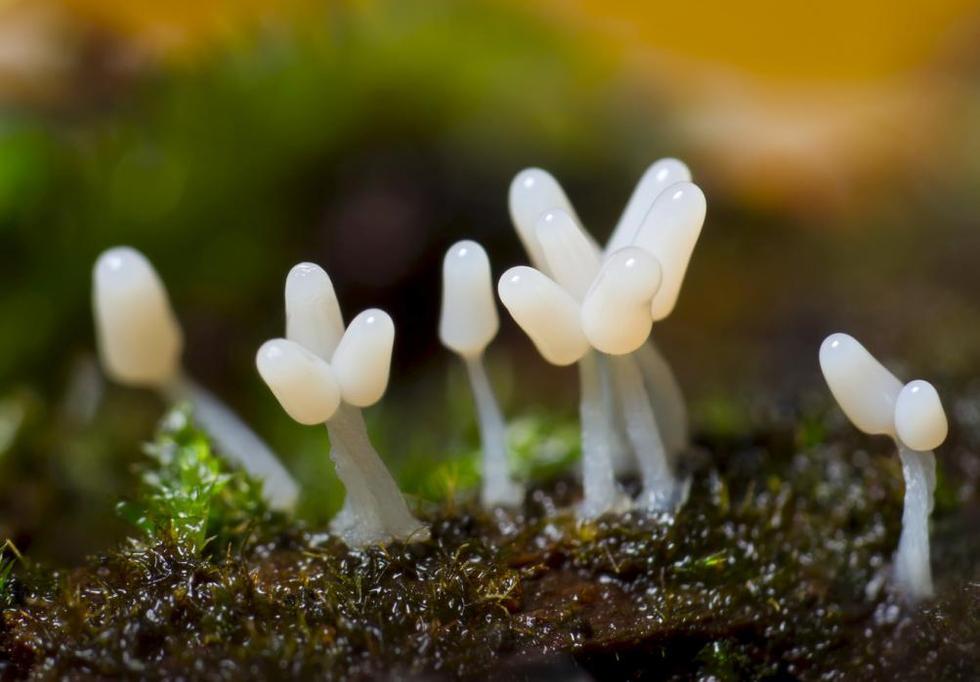 显微镜下微生物如“外星森林”