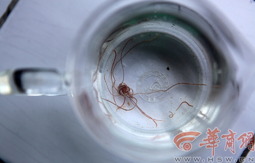 西安某家属院自来水飘满红线虫 市民称很恶心