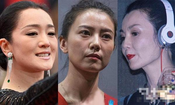 女明星致命缺陷：Angelababy喉结大周迅似长老人斑