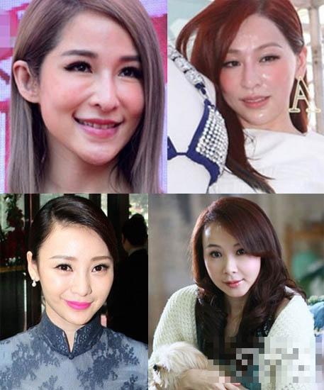 女明星致命缺陷：Angelababy喉结大周迅似长老人斑