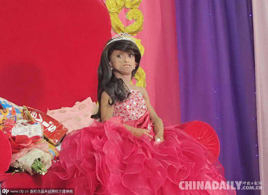 菲律宾年纪最大早衰女孩庆祝18岁生日