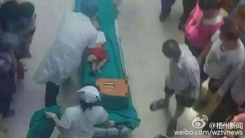 广西梧州1岁多幼童手臂被卷入电梯受伤