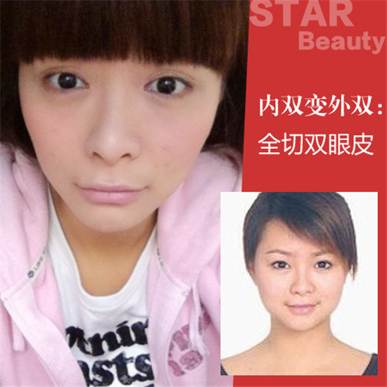 一览无遗！柳岩倒立衣服滑落露小蛮腰