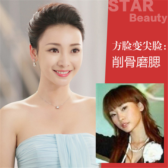 一览无遗！柳岩倒立衣服滑落露小蛮腰