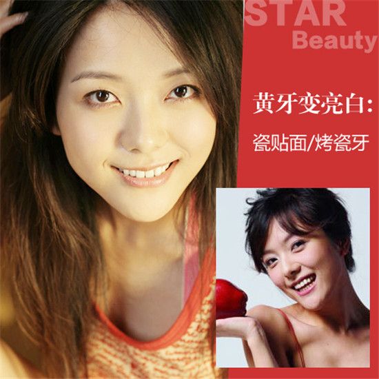 一览无遗！柳岩倒立衣服滑落露小蛮腰