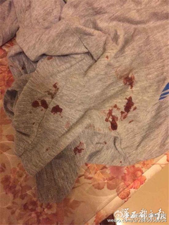 两狗咬架引冲突 夫妻合力咬伤另一狗主人(图)