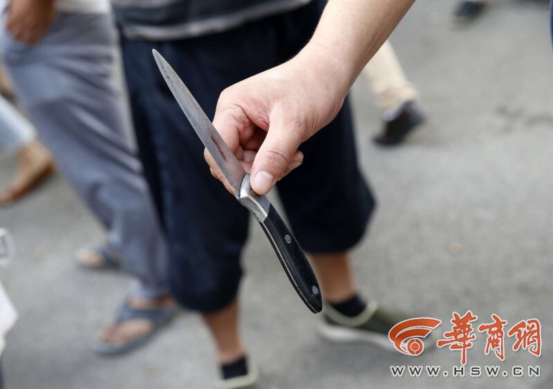 西安：狗车被动保人士拦下 司机妻子用匕首捅腿