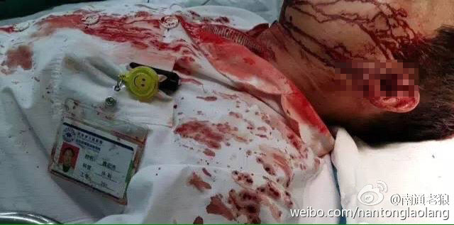江苏一医生遭病人家属殴打致头皮撕裂