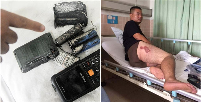 男子手机放口袋爆炸 大腿被炸伤