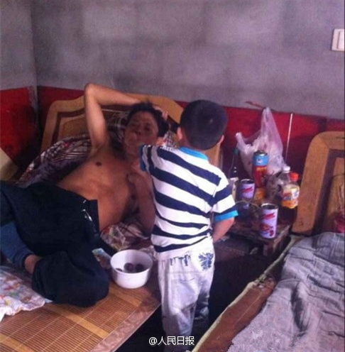 父亲肺癌晚期母亲严重智障 6岁娃独自照顾父亲