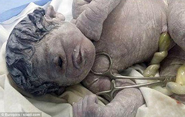埃及出现天生一只眼婴儿 或受放射物影响