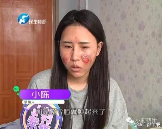 河南女子想喝水懒起床 躺着拿水壶遭烫伤毁容