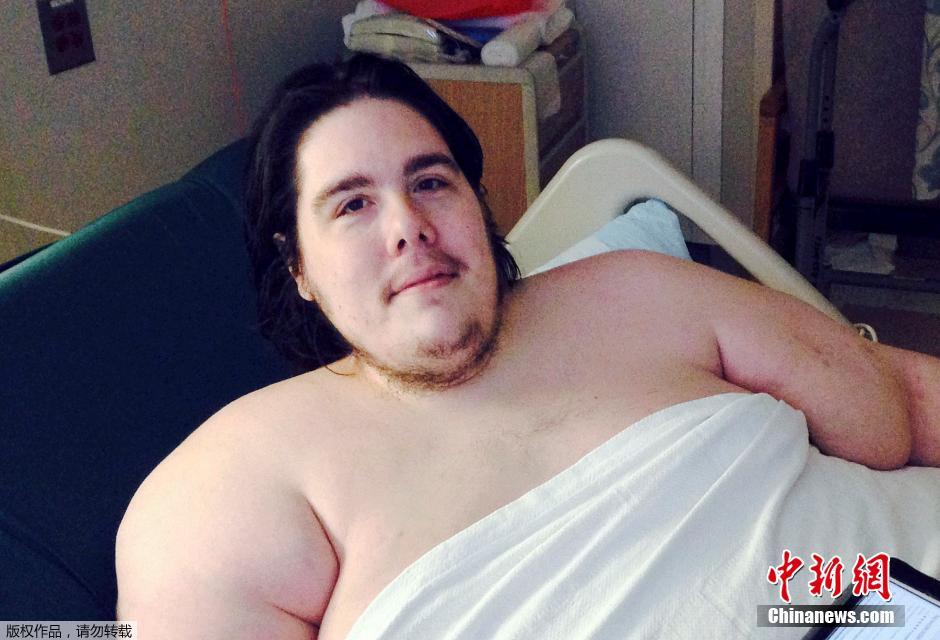 美国720斤胖子因减肥时偷吃被医院赶出门