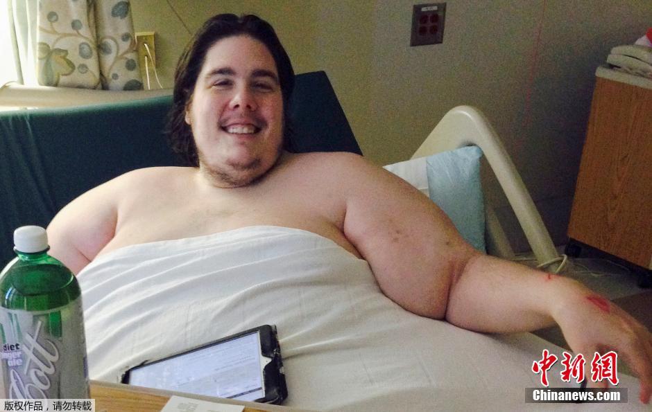 美国720斤胖子因减肥时偷吃被医院赶出门