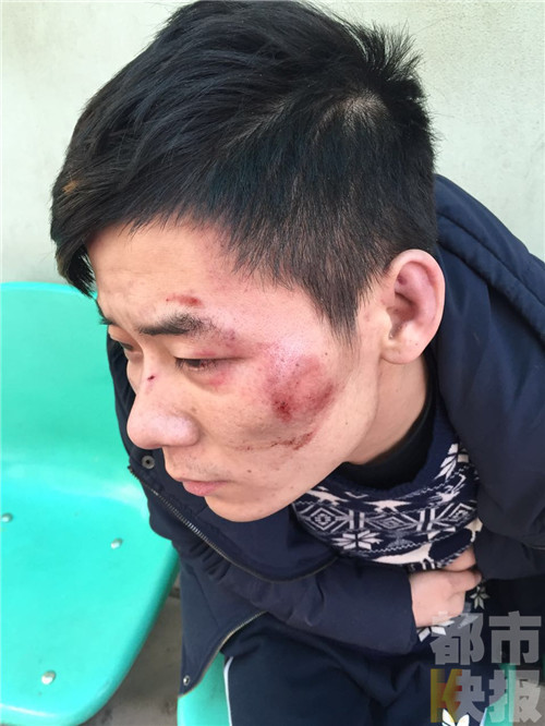 西安一男子上厕所因“多看一眼”被群殴