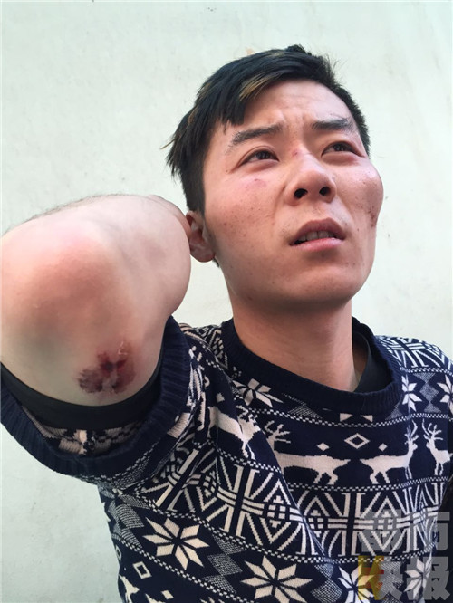 西安一男子上厕所因“多看一眼”被群殴