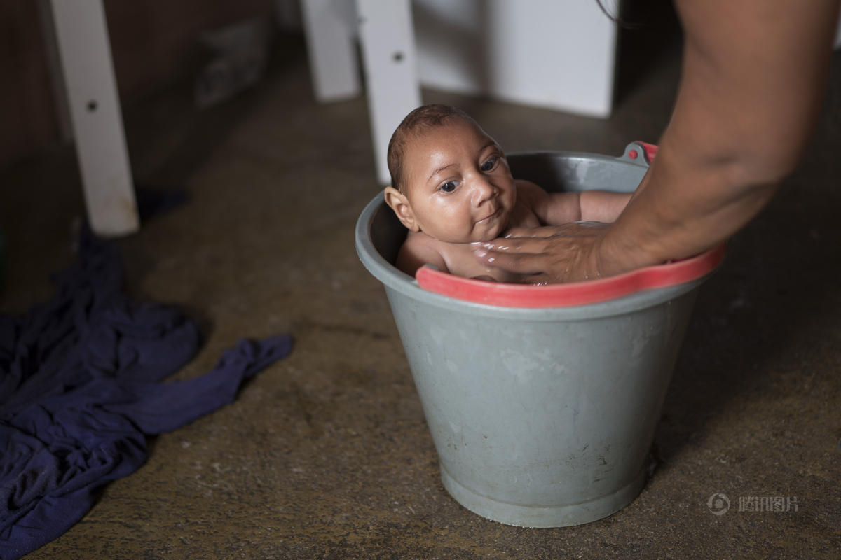 巴西罕见病毒致婴儿小头 政府建议勿怀孕