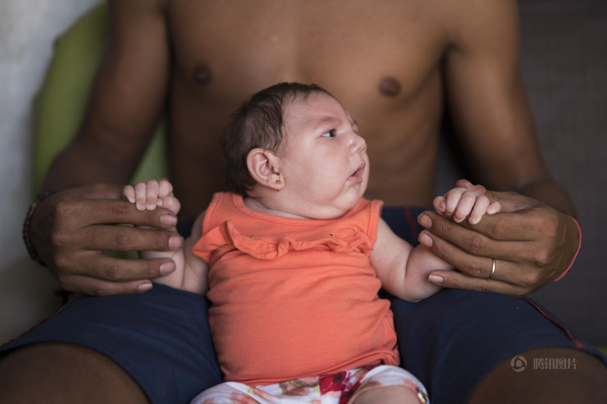 巴西罕见病毒致婴儿小头 政府建议勿怀孕