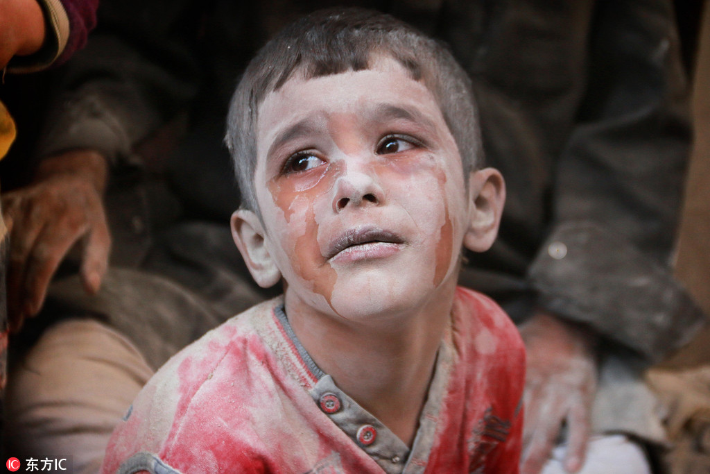 俄罗斯战机空袭阿勒颇居民区 儿童被炸伤令人痛心