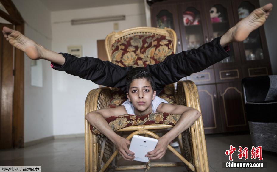 巴勒斯坦少年凭软骨功打破世界纪录 被称“蜘蛛侠”
