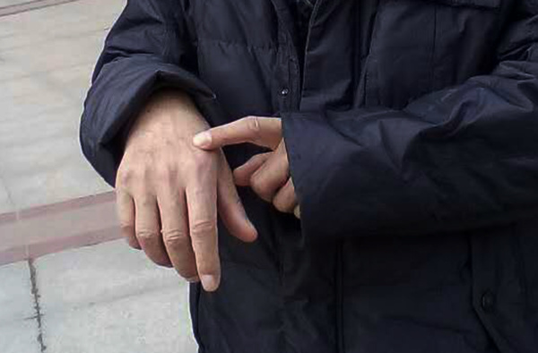 跳舞遭钢珠袭击 警方提醒袭击者:别从受害者变成违法者