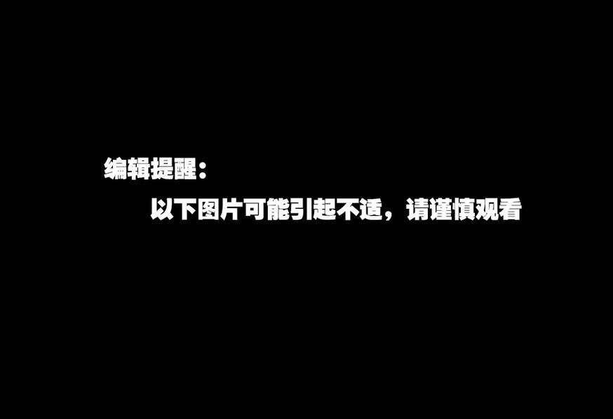 安徽2女子把小狗绑车尾拖行 现场血肉模糊