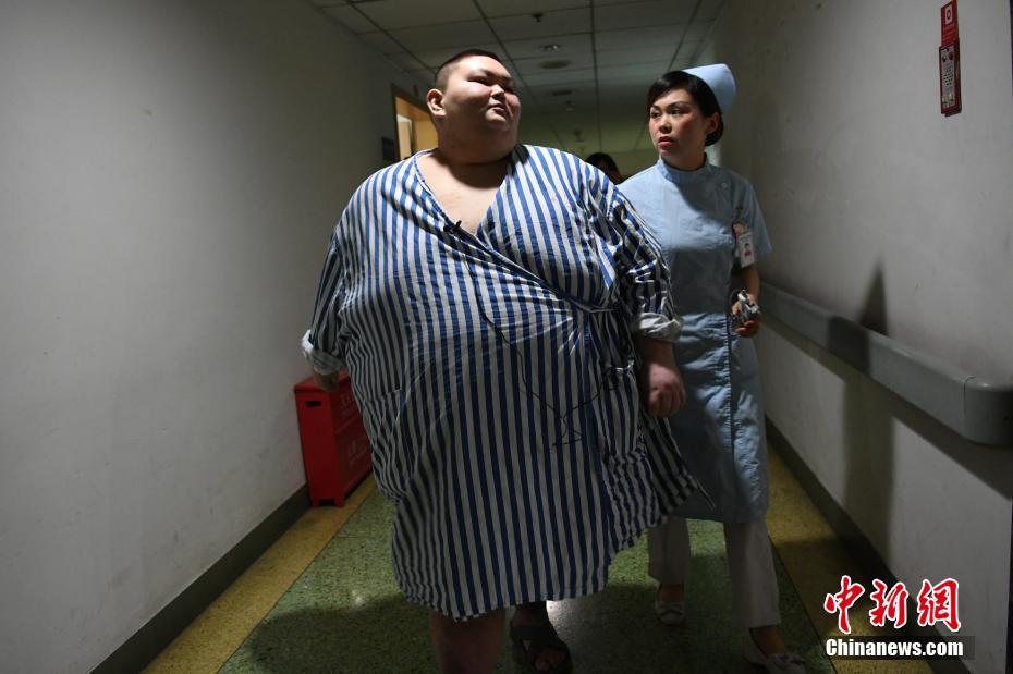 体重曾达530斤武汉男子迎来减重手术