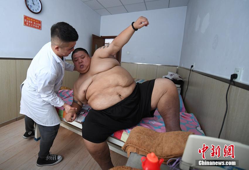 480斤肥胖男子立志减肥 期待恢复健康后照顾双亲