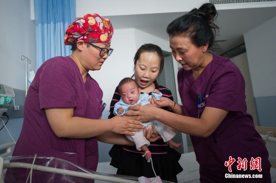 山西首例孕24周“手掌婴儿”救治成功