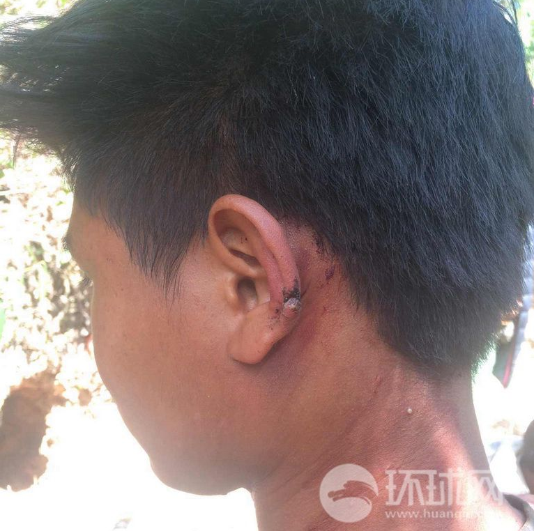 果敢同盟军与缅军交战照片