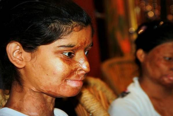 印度被泼硫酸毁容女孩的咖啡厅