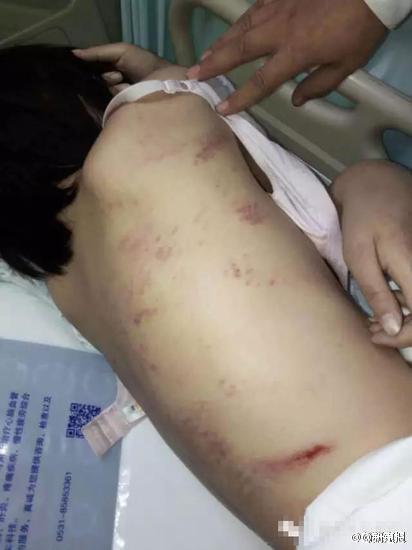 小周背上也全是伤痕.