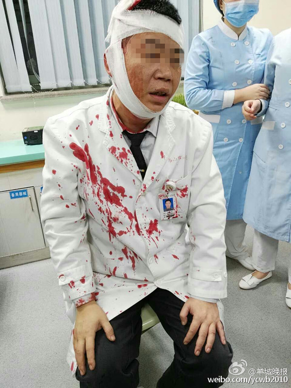 医生头部被患者用铁锤连砸三下 继续诊病